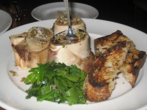 Bone Marrow 300x225 